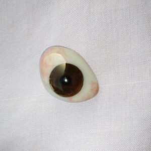 prosthetic lens